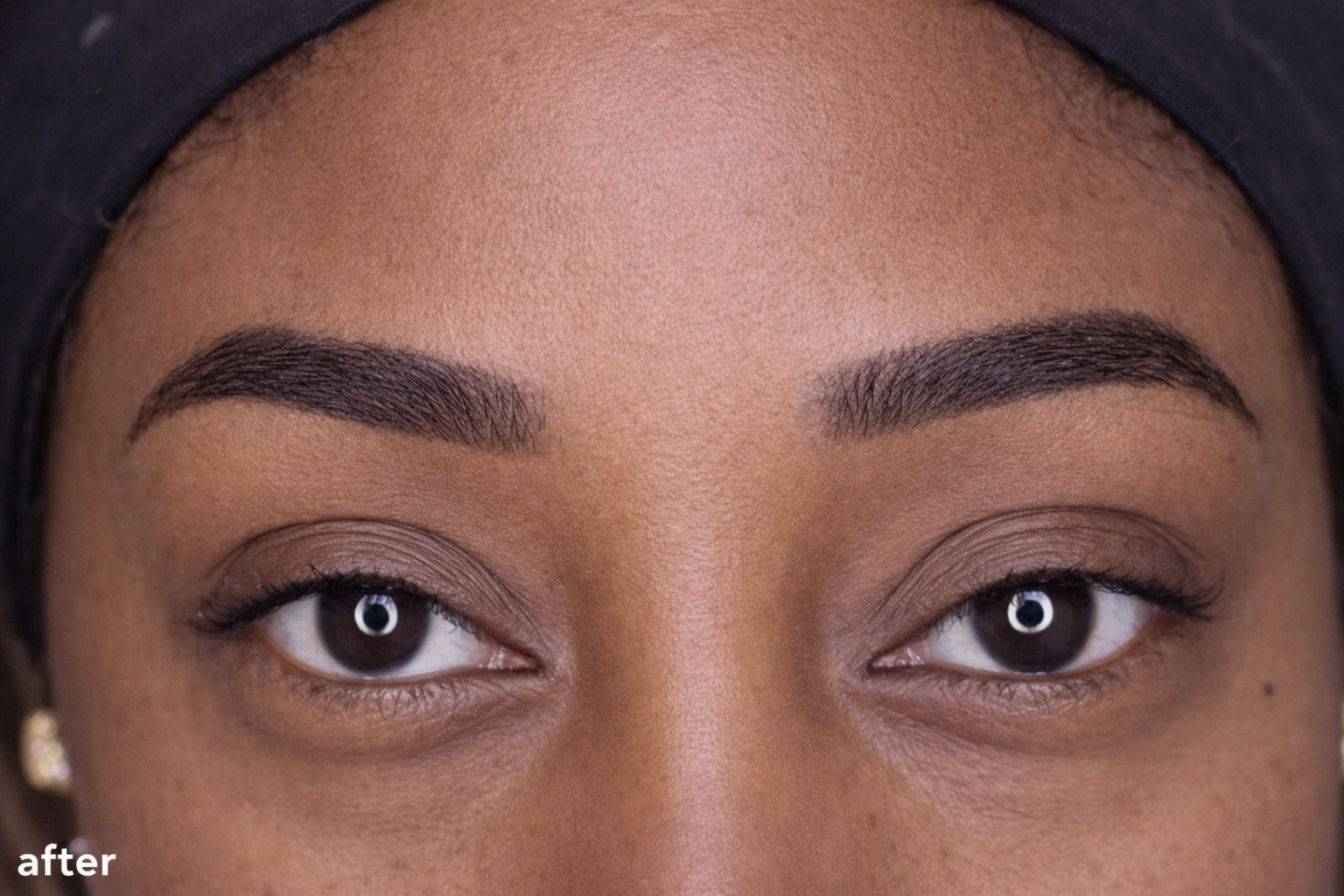 Lash line enhancement result
