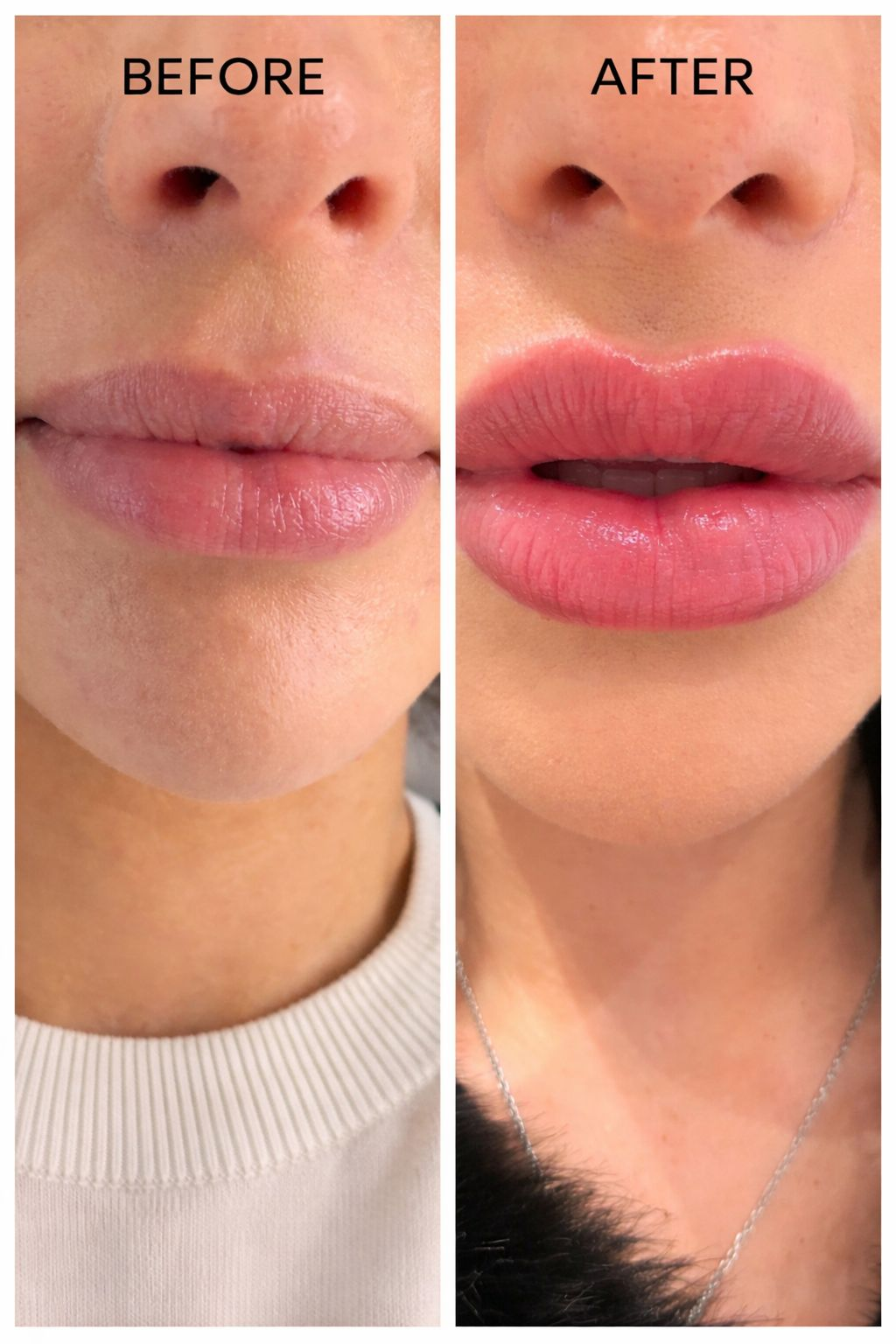 Lip blush result before and after